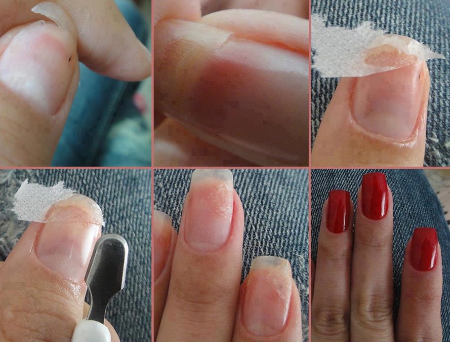 remendar unhas2 Como remediar unha lascada